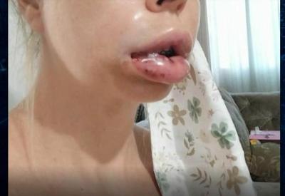 Dentista é acusada de deformar rosto de 18 pacientes no Rio