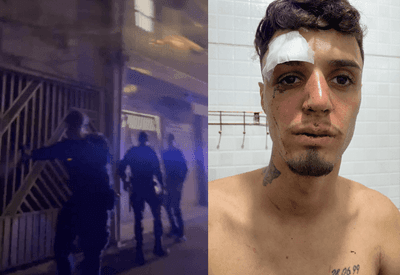 Ouvidoria apura denúncia de agressão e possível tortura de PMs contra motoboy em SP