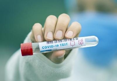 Covid-19: testes positivos atingem nível do auge da pandemia em SP