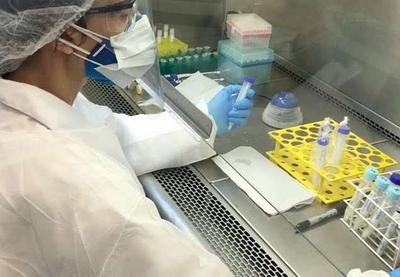 Estudo irá mapear população infectada pelo novo coronavírus na cidade de SP