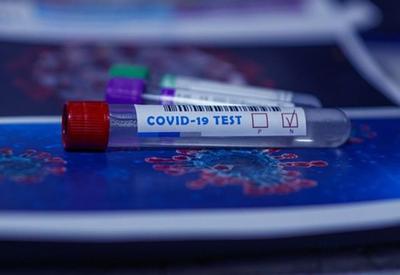Testes para Covid-19 por meio da saliva são vendidos em farmácias