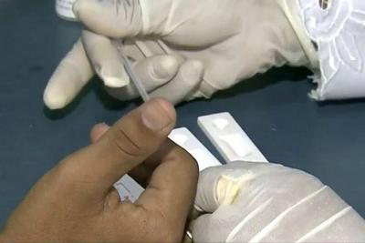 Faltam testes para detectar HIV em alguns estados