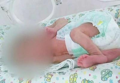 Família acusa maternidade por queimaduras em recém-nascida