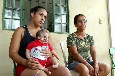 Família pede ajuda para bancar tratamentos de saúde de bebê