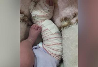 Bebê tem perna quebrada durante parto em hospital público da Serra
