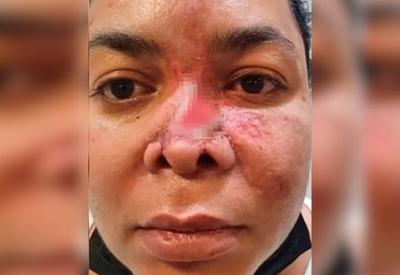 Mulher perde parte do nariz após realizar procedimento estético no DF