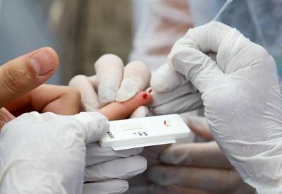 Farmácias registram recorde de testes positivos para a Covid-19