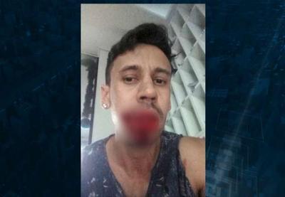 Homem é baleado por vizinho depois de festa em São Paulo