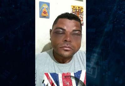 Homem reclama de atendimento e tem rosto desfigurado por médico em Sorocaba
