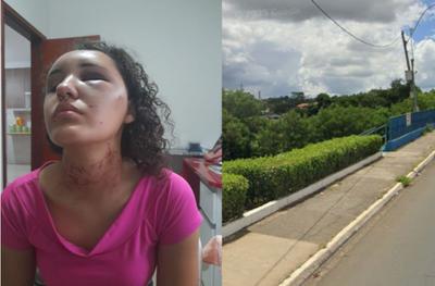 Jovem finge estar morta para escapar de tentativa de estupro em Hortolândia (SP)