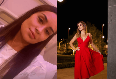 O que é a osteomielite, infecção que afeta ex-BBB Letícia Santiago