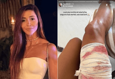 Mulher leva mordida de tubarão enquanto mergulhava em Fernando de Noronha