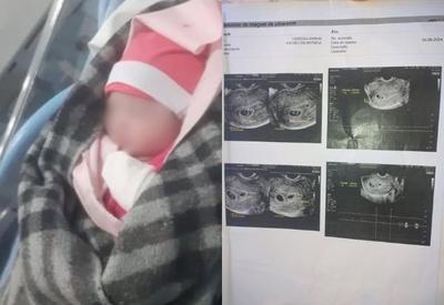 Mulher dá à luz um filho após exames mostrarem gravidez de gêmeos