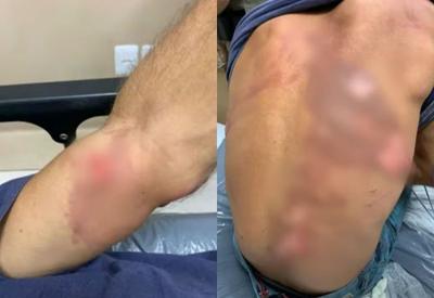 Homem é preso por torturar funcionário, obrigado a decepar o próprio dedo