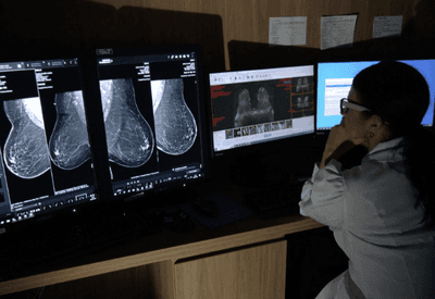 ANS amplia faixa etária para mamografia na rede privada