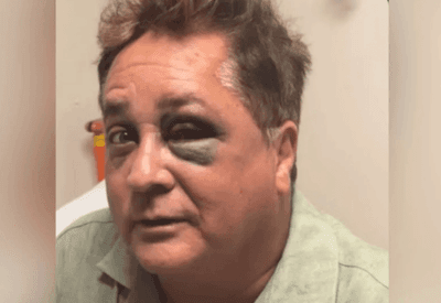 Leonardo sofre queda no Pantanal e esposa atualiza estado de saúde do cantor