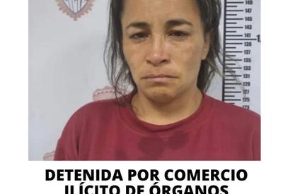 Mulher que vendia rins humanos no Facebook é presa na Venezuela