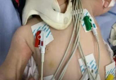 Médica aciona polícia após examinar bebê com mais de 30 lesões no corpo