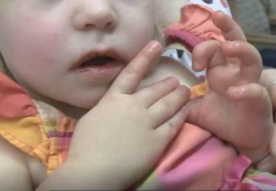 Médicos alertam para risco de síndrome rara em crianças infectadas pela Covid-19