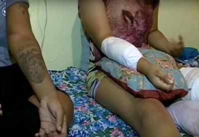 Jovens denunciam agressões de facão e cassetete  em Vitória (ES)