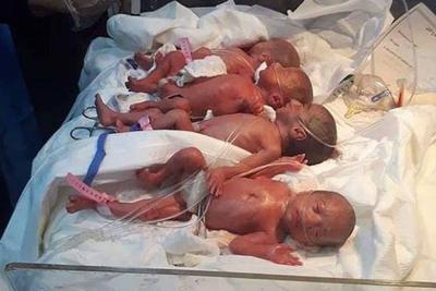 Mulher de 25 anos dá à luz sete bebês em parto normal