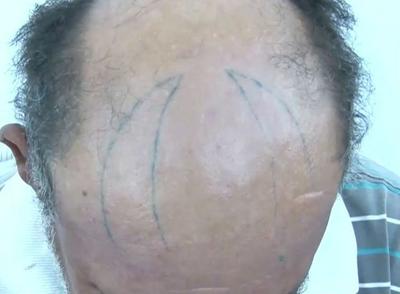 Mulher tatua chifre na cabeça do marido com ajuda de amante