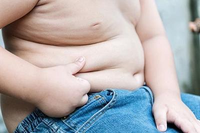 Mundo terá quase 1 bilhão de crianças acima do peso até 2035