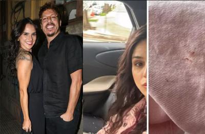 Namorada de Fábio Porchat é ferida após tentativa de assalto em SP 