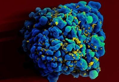 Vacina promissora contra HIV é testada em humanos