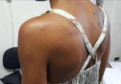 Polícia prende homem que torturou ex-mulher com chicotadas em SP