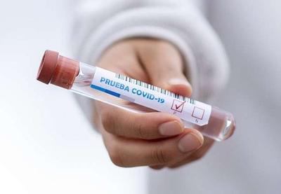 Tanzânia revê testes de coronavírus após bode e mamão testarem positivo