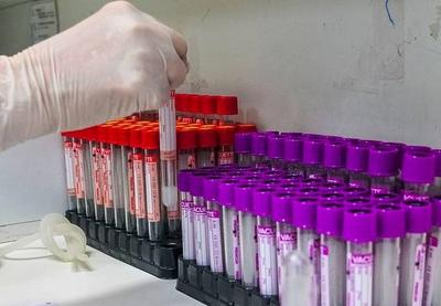 UFRJ começa ensaios clínicos de vacina BCG contra Covid-19