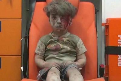 Veja como está o menino que comoveu o mundo e virou símbolo do drama na Síria