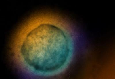 Nipah: Índia monitora surto de vírus mortal após registro de 5 infecções no país