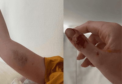 Ex de Dado Dolabella, Marcela Tomaszewski posta prints e fotos de agressões 