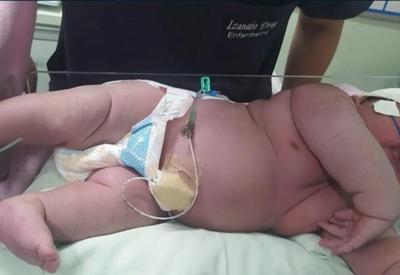 "Bebê gigante" nasce com mais de sete quilos e quase 60 centímetros