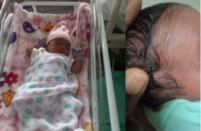 Recém-nascida é atingida por tiro de raspão na cabeça em hospital no Recife
