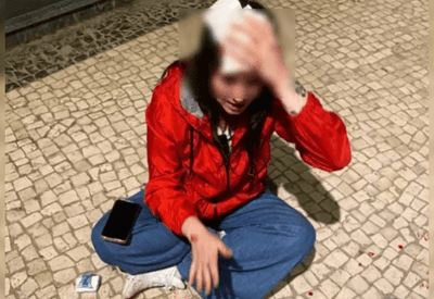 Brasileira é atacada com pedrada na cabeça em Portugal