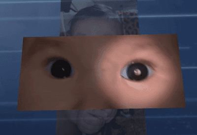 Mês de atenção ao retinoblastoma reforça a importância do diagnóstico precoce