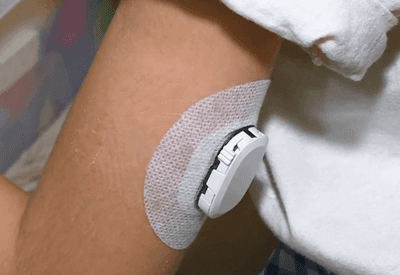 Projeto de lei propõe sensores gratuitos para controle de diabetes 