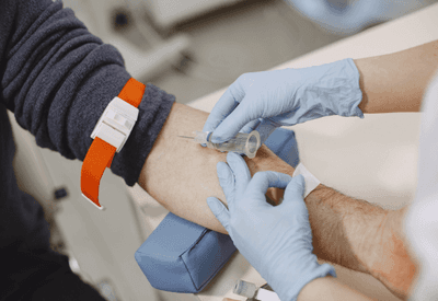 FDA autoriza primeiro exame de sangue para detectar Alzheimer nos EUA