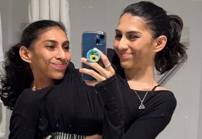 Gêmeas siamesas respondem a dúvidas inusitadas até sobre vida sexual: 'Somos pessoas distintas'