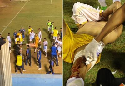 Goleiro do Grêmio Anápolis leva tiro de bala de borracha de PM após jogo; veja vídeo