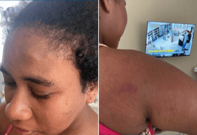 Grávida de seis meses é agredida por patroa no Maranhão