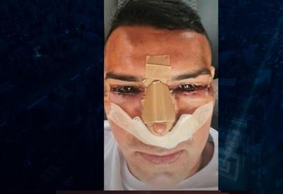 Criminoso faz cirurgia plástica no rosto para não ser reconhecido pela polícia