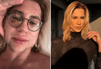 Influencer Junior Dutra denunciou profissional antes de morrer por complicações de procedimento estético