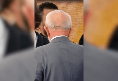 Vídeo: veja como ficou ferimento de Lula após queda em banheiro