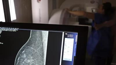 ANS propõe aumentar para 50 anos a idade mínima para mamografia 