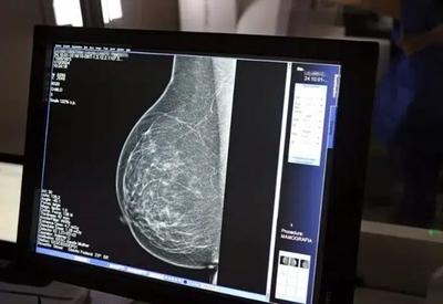 Mamografia sem dor: inovação tecnológica promete exame mais confortável e preciso