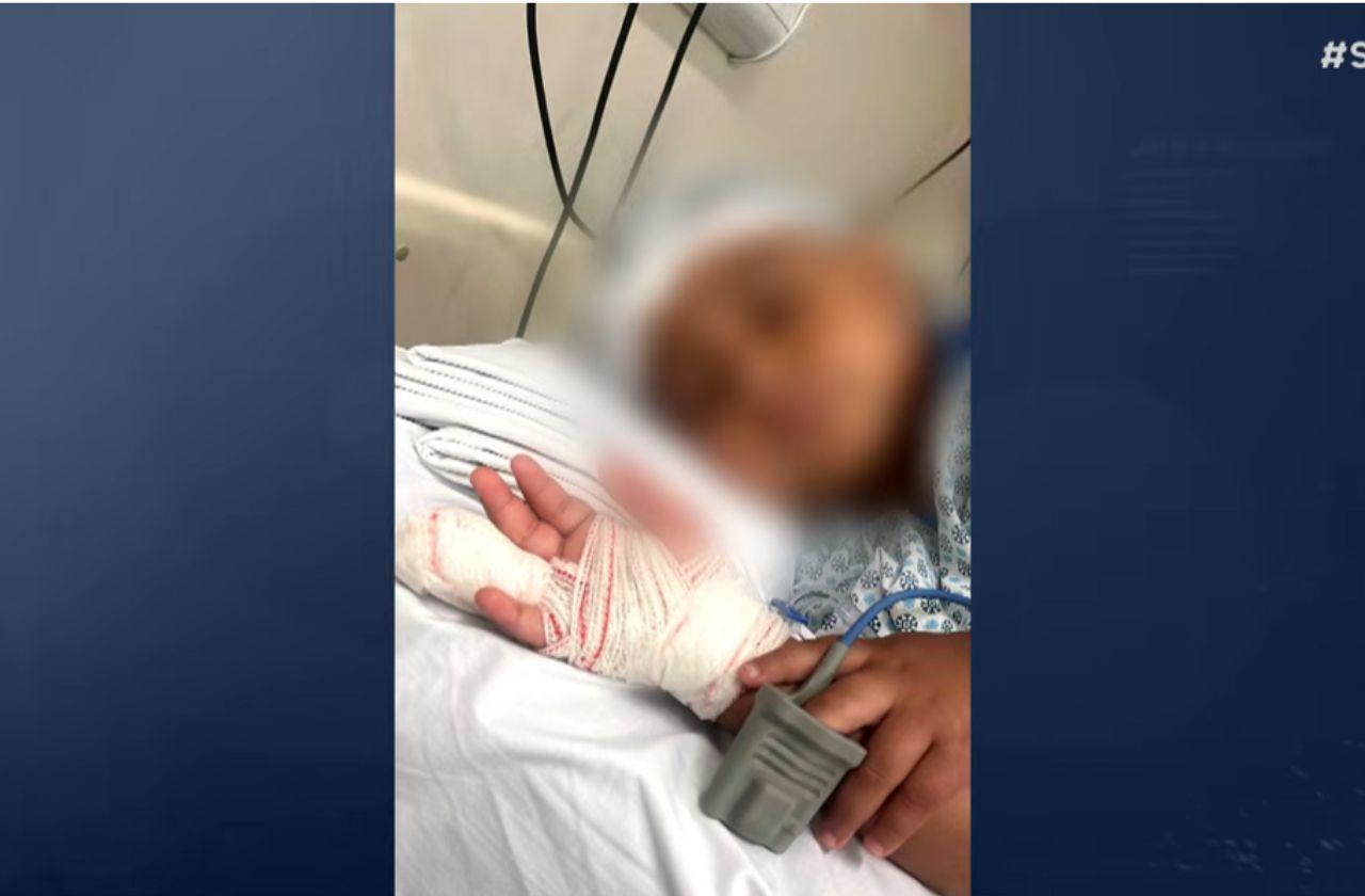 Criança de 4 anos tem parte do dedo amputado em creche de Sorocaba (SP)